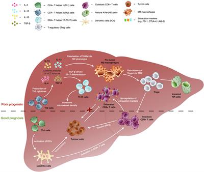 Combinational Immunotherapy for Hepatocellular Carcinoma: Radiotherapy, Immune Checkpoint Blockade and Beyond